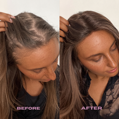 Rosemary PDRN Scalp Serum – Root Strengthening & Hair Revitalizing