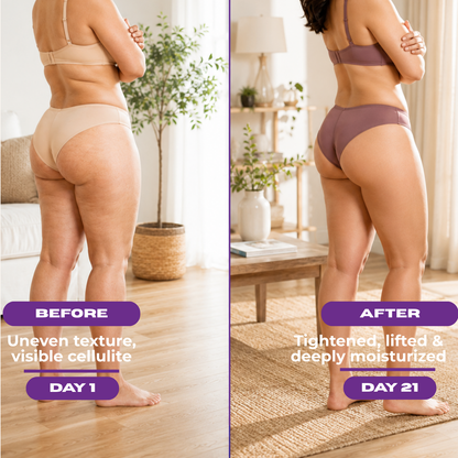 Firming Body Cream for Cellulite – Buttocks & Thighs